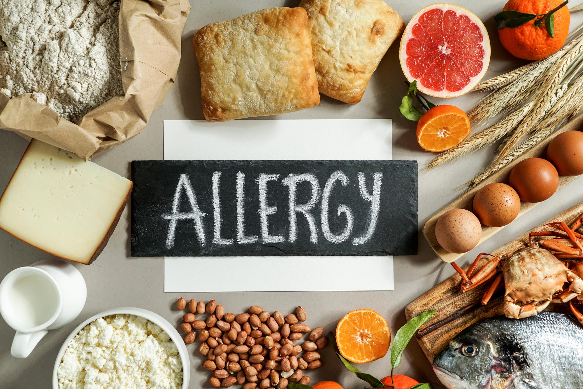 service-food-allergy